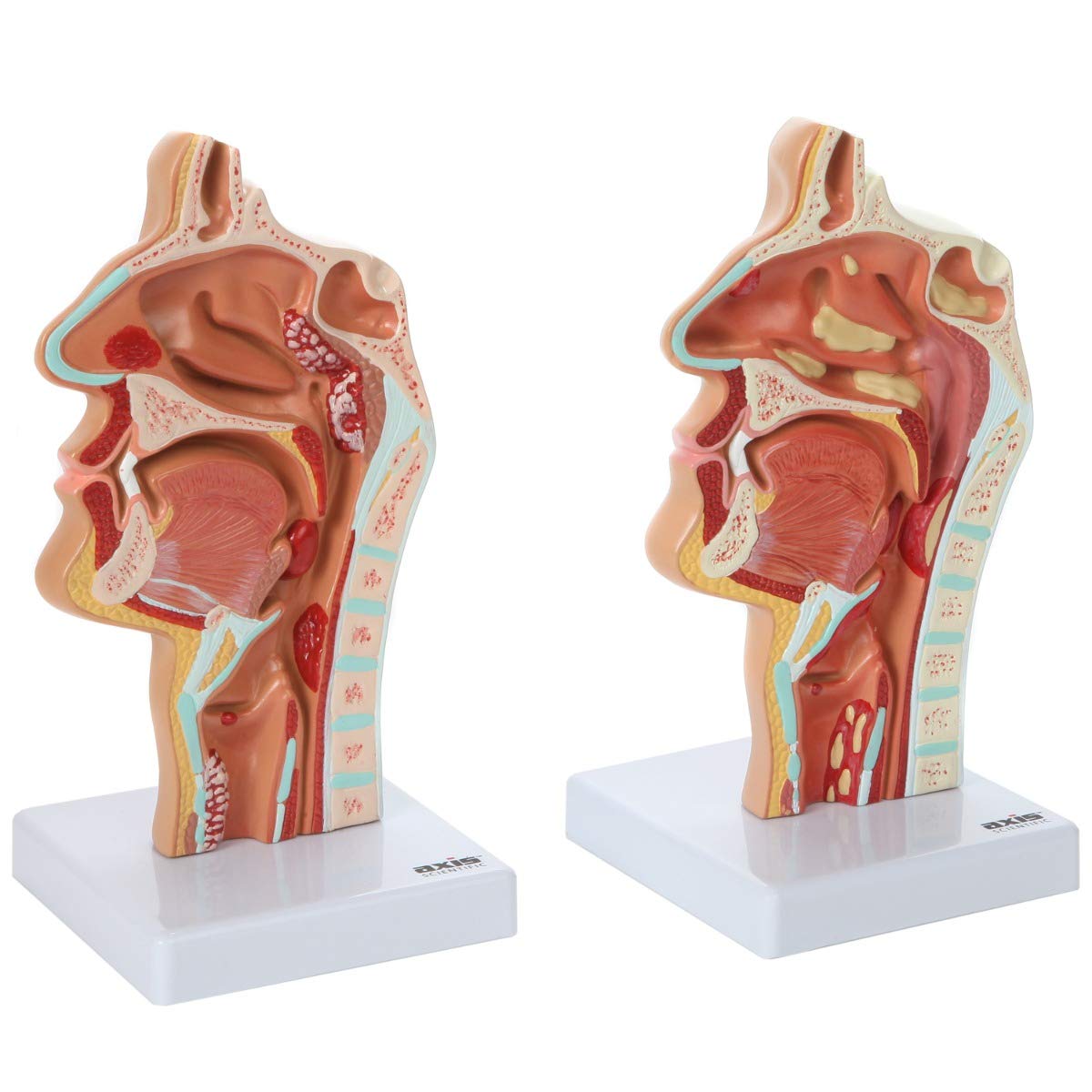 Axis Scientific Human Larynx and Pharynx Disorders Model | Shows Normal Larynx and Pharynx Anatomy and Details Common Abnormalities | Comes on White Base