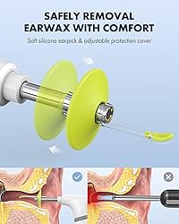 Anykit Wireless Otoscope Ear Camera with Dual