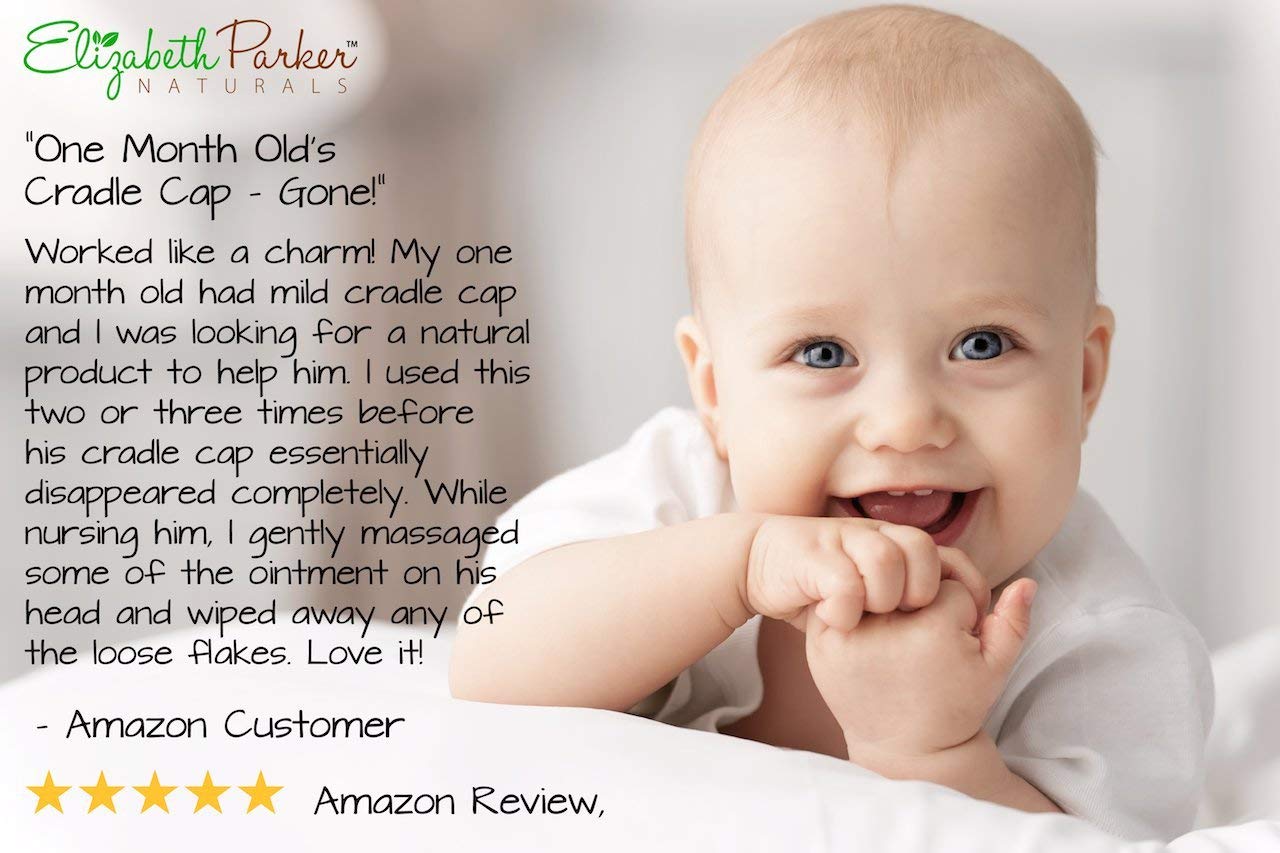 selsun blue cradle cap face