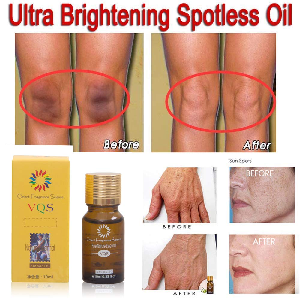 dark spot remover for skin