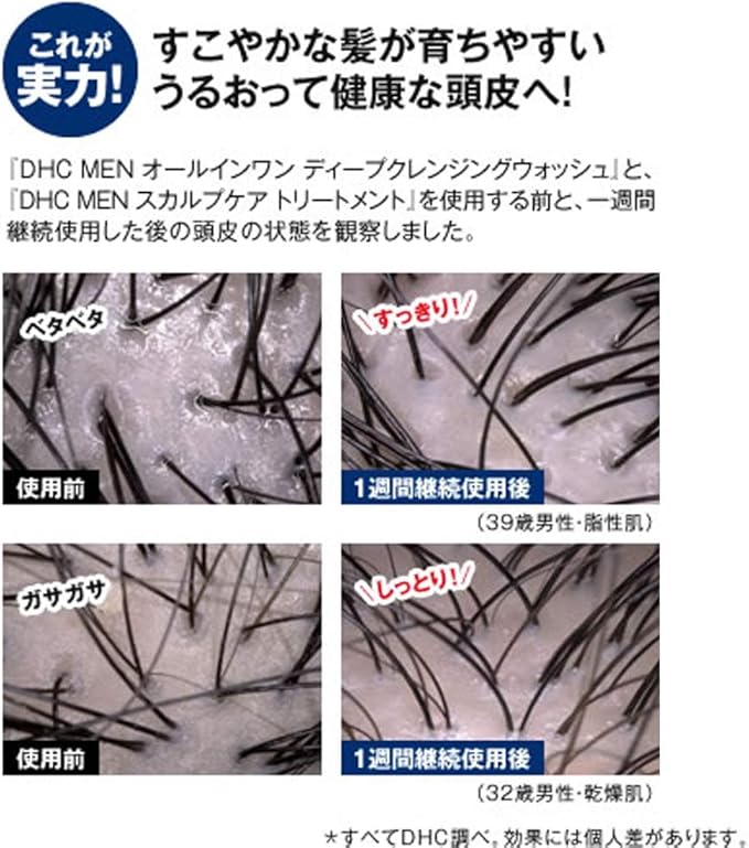 Dhc Men スカルプケア トリートメント Dhc ディー エイチ シー ヘアトリートメント 通販 Amazon