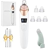 2026 Pore Vacuum, Blackhead Remover with 3 Adjustable Suction Levels, USB Rechargeable, 5 Replaceable Heads for Face Deep Cleansing, Includes Blackhead Spatula for Women & Men Blackhead Remover Vacuum