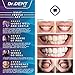 DrDent Premium Teeth Whitening Kit 35% CP | LED Light | (2) 5ml Whiten Gels | Removes Stains – Includes Mouth Tray & Shade Guide – Rapid & Effective Results – User-Friendly & Safe