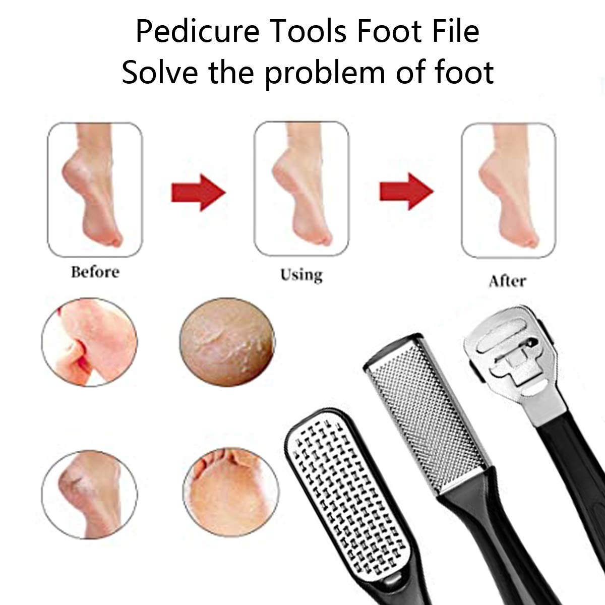 ALCKYSIR 23-In-1 Professional Pedicure Tool Set, with Foot Files and Rasp, Foot Grinder Callus Cuticle Remover, Toenail Clippers Set with Portable Storage Box for Women and Men : Beauty