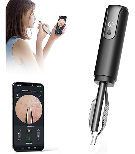 Blackhead instrument 吸引器 Amazon.com: Visible Blackhead Remover Magnifying Glass Microscope