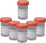 YUNYANZE 6 Pcs 60 ML Specimen Collection Containers Urine Bottle for Experiments view 1
