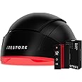 iRestore Elite + Rechargeable Battery Pack - Laser Red Light Therapy for Hair Growth - FDA Cleared Hair Loss, Hair Thinning Treatment for Men & Women - Hair Regrowth Laser Cap - 500 Lasers & LEDs