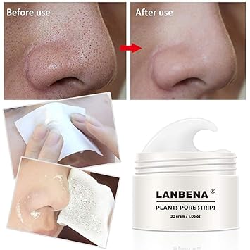 blackhead remover deep