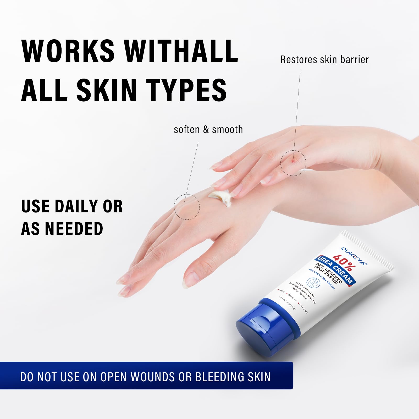 OUKEYA Urea Cream 40 Percent Tube 3 Oz, Foot & Hand Cream for Dry Cracked, 40 per Urea Lotion for Feet Maximum Strength