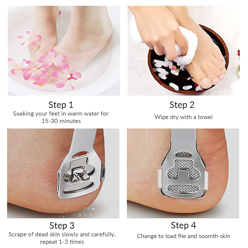 Codream Pedicure Callus Shaver Foot File Care Hard Skin Remover Callus Shaver Sets with Case, Foot File Heads & 10 Replacement Blade for Hand Feet : Beauty