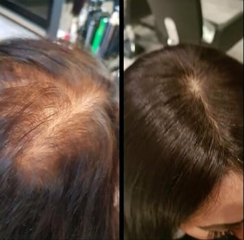 Amazon Com Full Shine Manual Suitable Mono Top Hair Piece 16 Inch