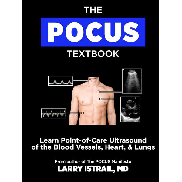 Ultrasound for Primary Care: 9781496366986: Medicine & Health
