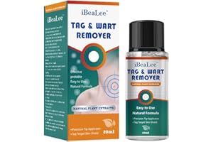 SEODON Wart Remover Liquid - 12% Wart Liquid with Salicylic Acid Botanical-Based Formula for Plantar and Common Warts.Suitable for People with Most Skin Types (1pack)