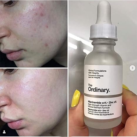 Ordinary Niacinamide Review