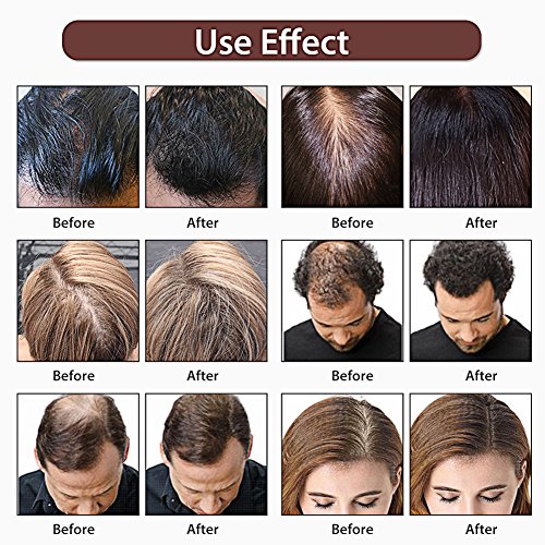Hair Growth Hair Growth Serum Hair Growth Essence Hair Growth