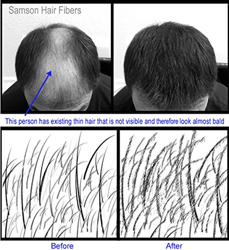 image for Samson Hair Building Fibers Hair Loss Concealer MEDIUM BROWN large REF