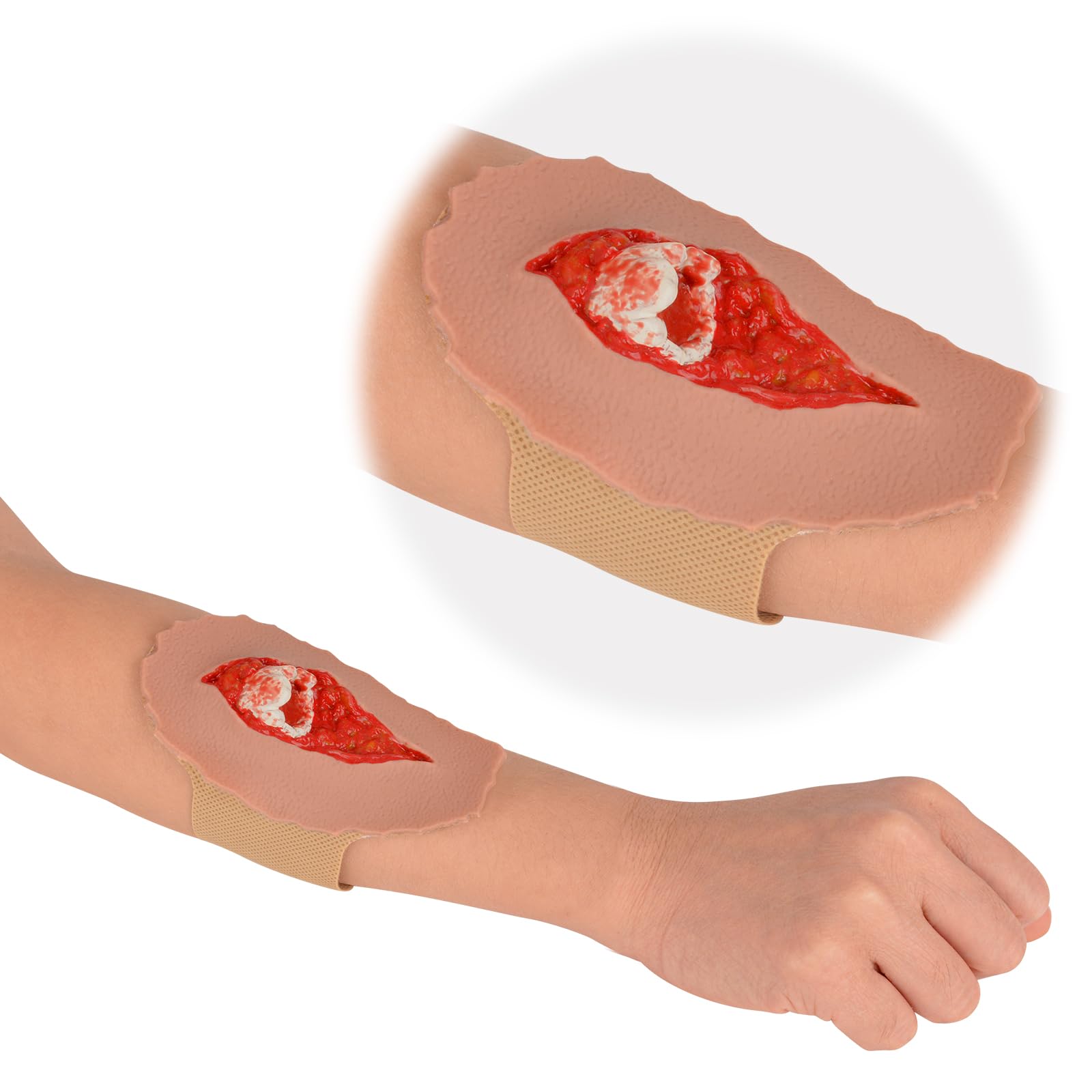 MedEduQuest Open Fracture Wound Packing