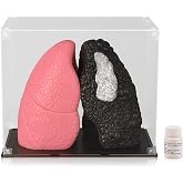 Ultrassist Healthy and Smoker Lung Model, Life Size | Soft silicone anatomy, black/pink comparison, transparent acrylic dust cover, for smoking education and display