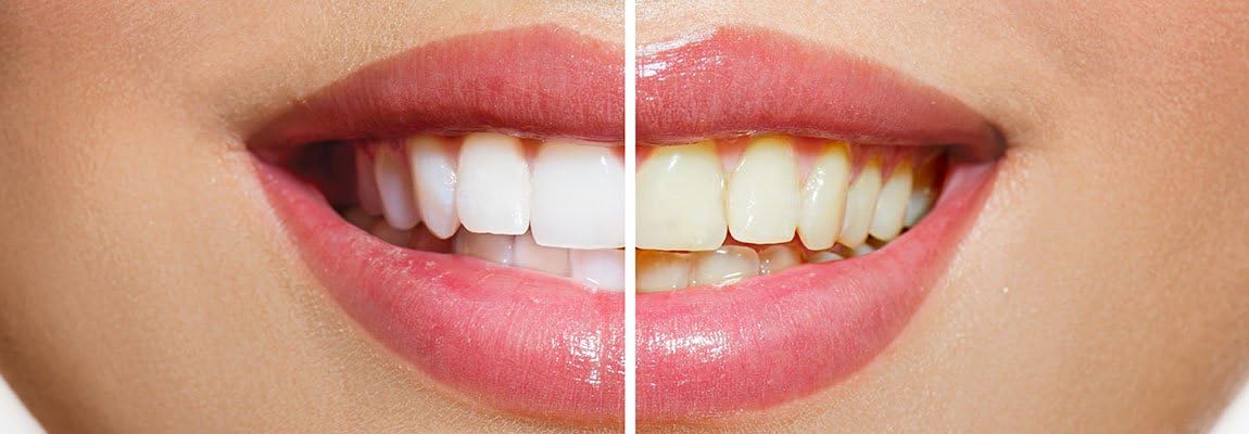 Opalescence Whitening Toothpaste Cool Mint with Fluoride 100ml, 100 ml (Pack of 1) - Image 5