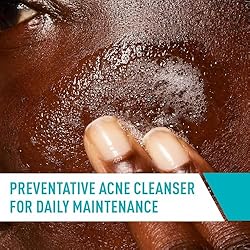 CeraVe Acne Treatment Face Wash, Salicylic Acid