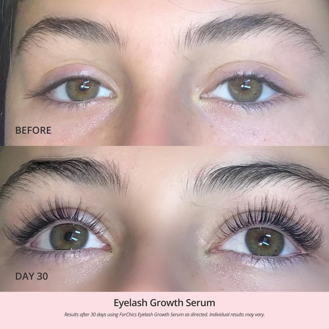 ForChics Eyelash Growth Serum - Prostaglandin-Free Lash Enhancing Serum for Longer, Thicker Lashes and Brows- Natural Formula, Visible Results in 2 Weeks - Vegan, Hormone-Free 0.10 fl. oz / 3ml