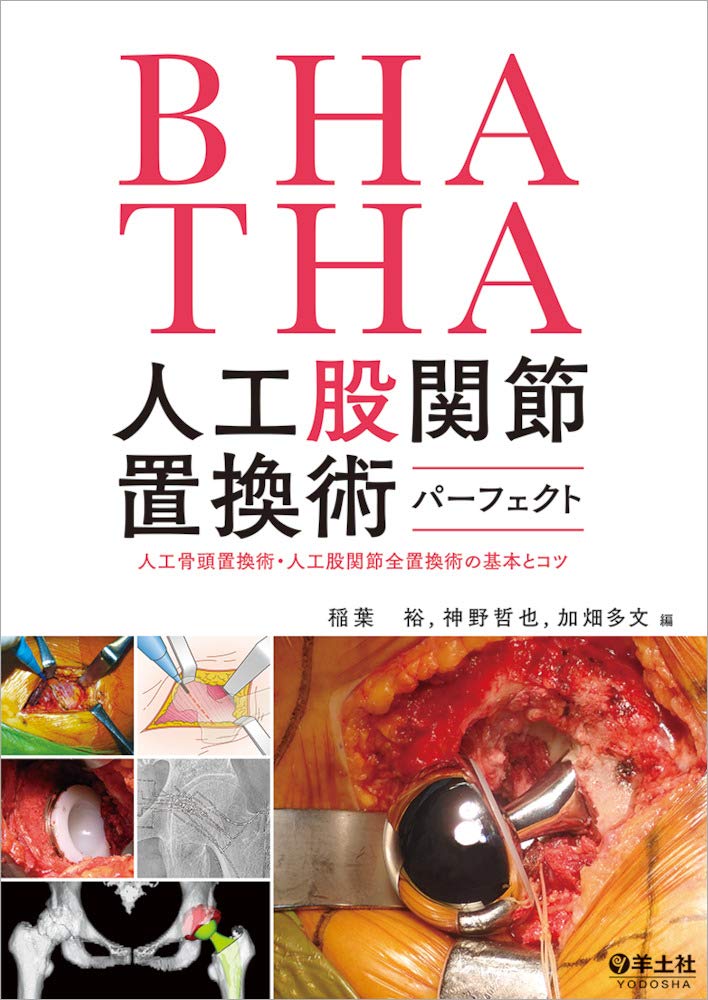 Bha Tha 人工股関節置換術パーフェクト 人工骨頭置換術 人工股関節全置換術の基本とコツ 9784758118965 Amazon Com Books