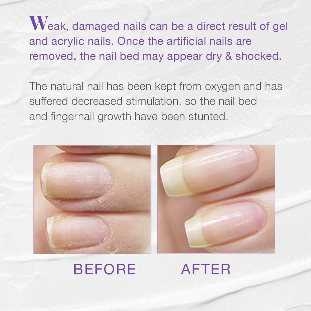 Nail Tek Xtra 4, Nail Strengthener for Weak and Damaged Nails, 0.5 oz, 1-Pack : Nail Repair Products : Beauty