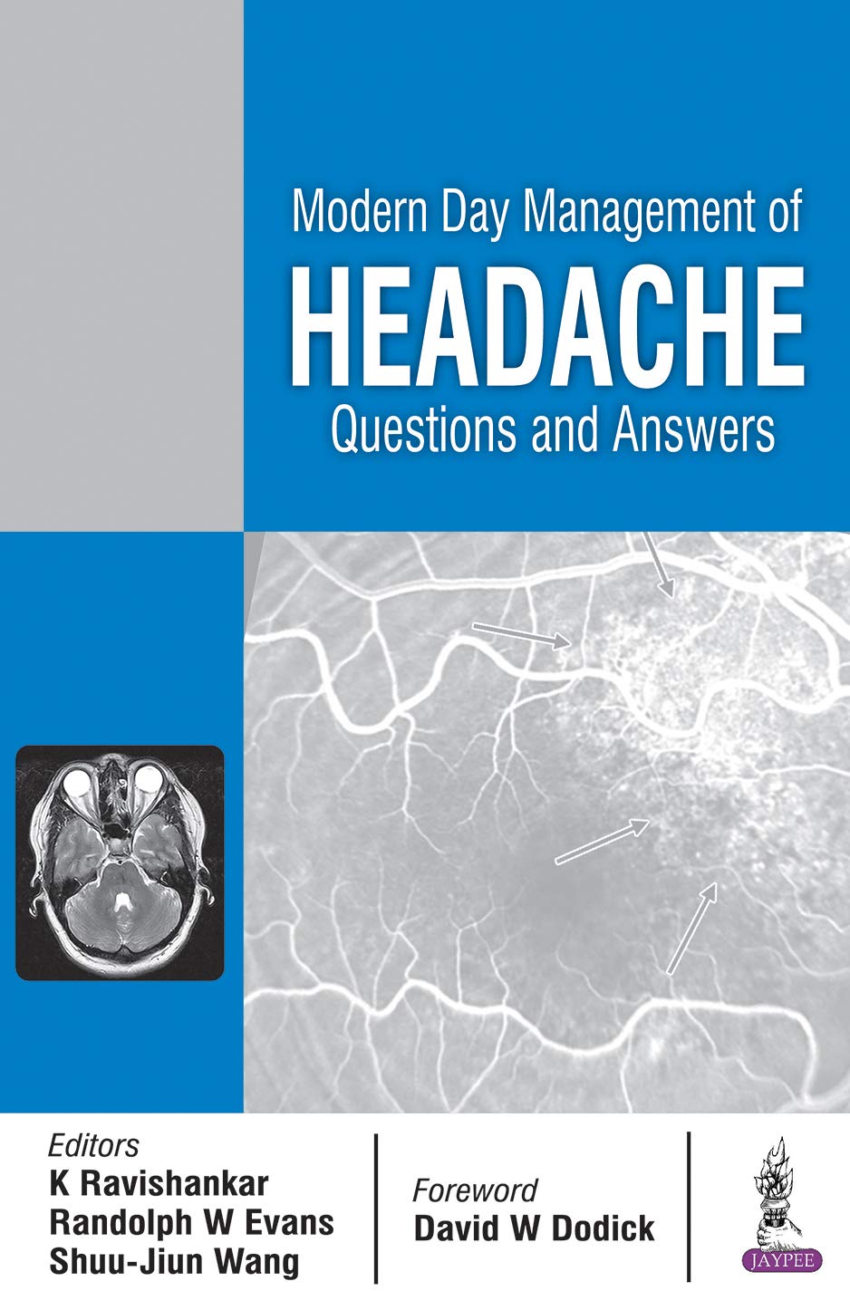 Modern Day Management Of Headache Questions And Answers Kindle Edition By Ravishankar K Evans Randolph W Wang Shuu Jiun Professional Technical Kindle Ebooks Amazon Com Modern Day Management Of Headache Questions And Answers Kindle Edition By Ravishankar K Evans Randolph W Wang Shuu Jiun Professional Technical Kindle Ebooks Amazon Com