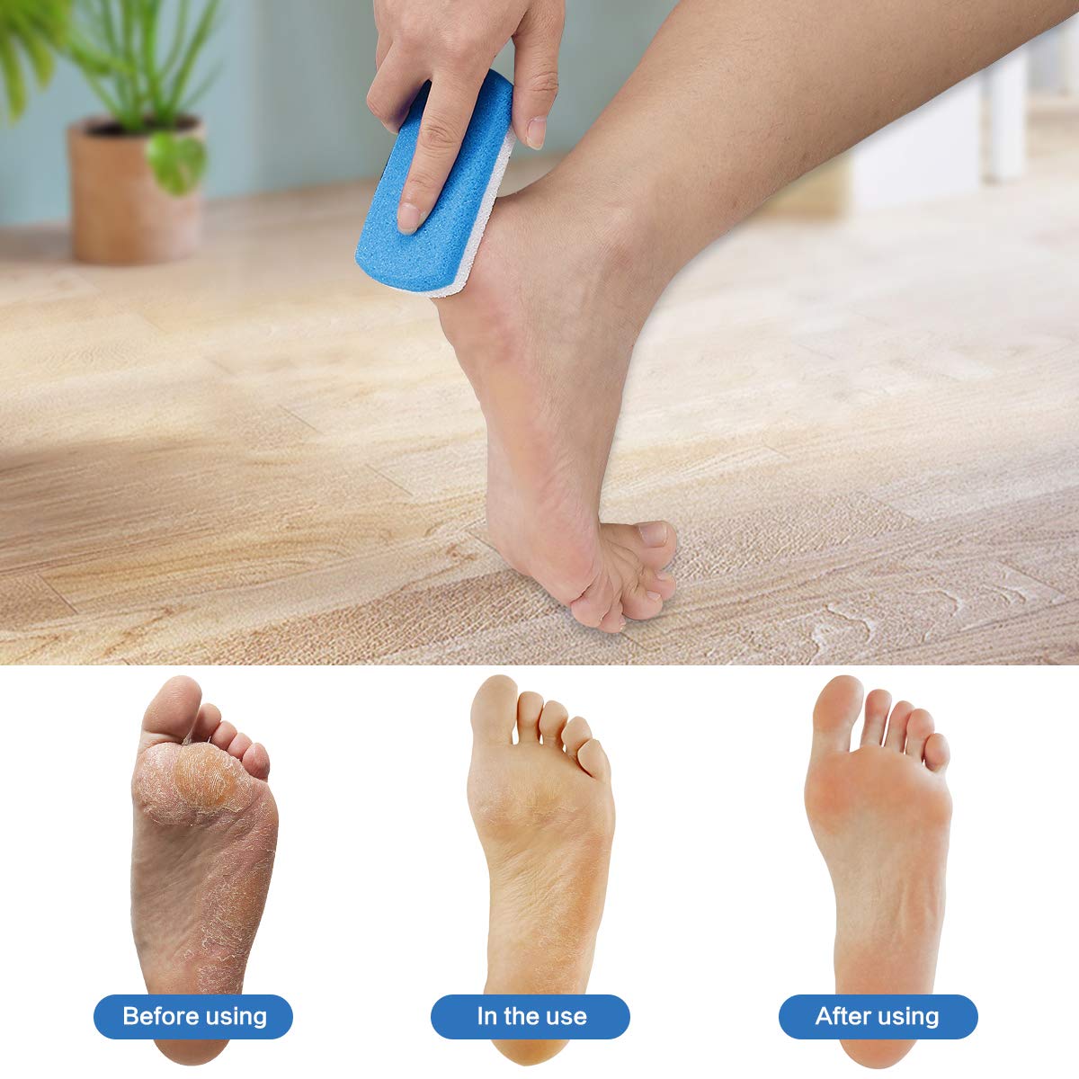 Codream Callus Removers for Feet, 2 in 1 Pumice Stone, Pedicure Stone Scrubber for Smooth Feet, Hands and Body, Foot scrubber & Pedicure Exfoliator Tool (Pack of 4): Beauty