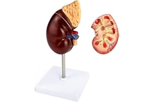 QWORK Life-Size Kidney Model, Divided into 2 Parts Showing Internal Structure A Normal Kidney Human Anatomy Replica for Docto