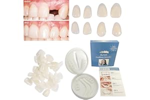 WOMCARE Tempoary Tooth Repair Kits DIY Dental Care Kit Glue for Filling Missing Broken Teeth Crowns and Bridges Moldable Fake Teeth to Regain Your Beautiful Smile in Minutes-White Color