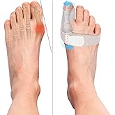 Yulatik 2 Pcs Toe Brace Splint for Women & Men, Rehabilitation Fixation Toe Fracture Brace Big Toe Fracture Fixation Hallux Valgus Correction Prevent Hallux Valgus Bunion Corrector, Day & Night