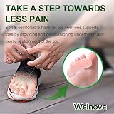 Welnove Hammer Toe Cushions Pads 10PCS Gel Toe Straightener Beige 3 Loops view 4
