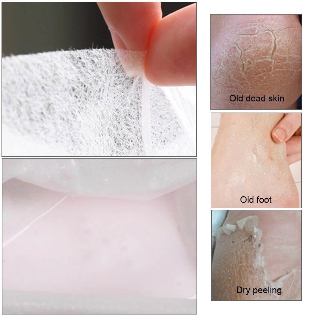 Minlop Peeling Fußpeeling Fußpflaster Erneuerungsmaske Entfernen Sie Harte Abgestorbene Haut Nagelhaut Ferse Fusspflaster, 1 Paar