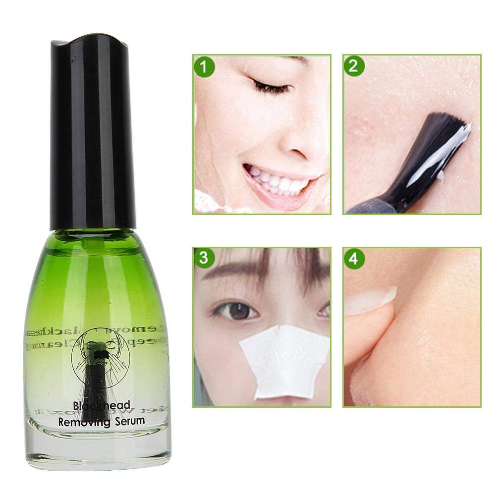 blackheads removal serum