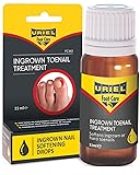 URIEL UPGRADED Ingrown Toenail Treatment, Ingrown