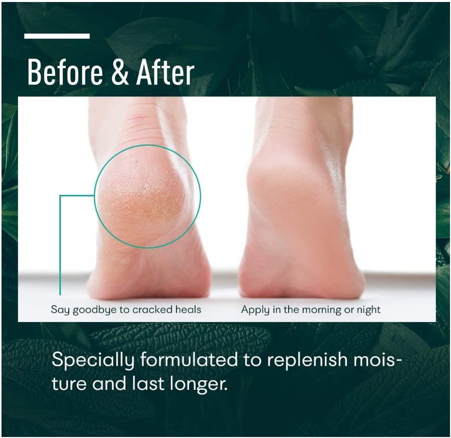 Ellocy Urea 42 Foot Cream for Dry Cracked Heels, Salicylic Acid, 5.29