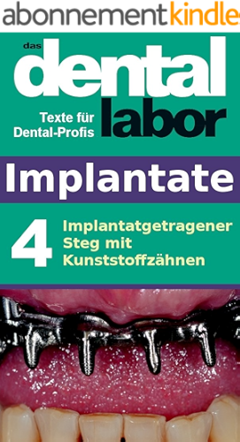 Download Implantatgetragener Steg mit Kunststoffzähnen (das dental labor Fachtexte 9) (German Edition) PDF