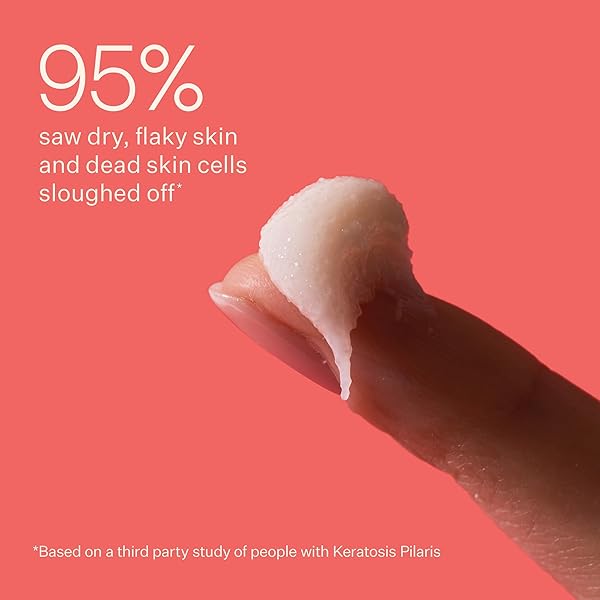 PEACH & LILY – KP BUMP BOSS MICRODERM BODY SCRUB (8.11 OZ) – 10% AHA + PHA – MICROEXFOLIANTS – HYALURONIC ACID, CICA, TEA TREE, SQUALANE, & CUCUMBER – SELF CARE – VEGAN & CRUELTY FREE – KOREAN BEAUTY