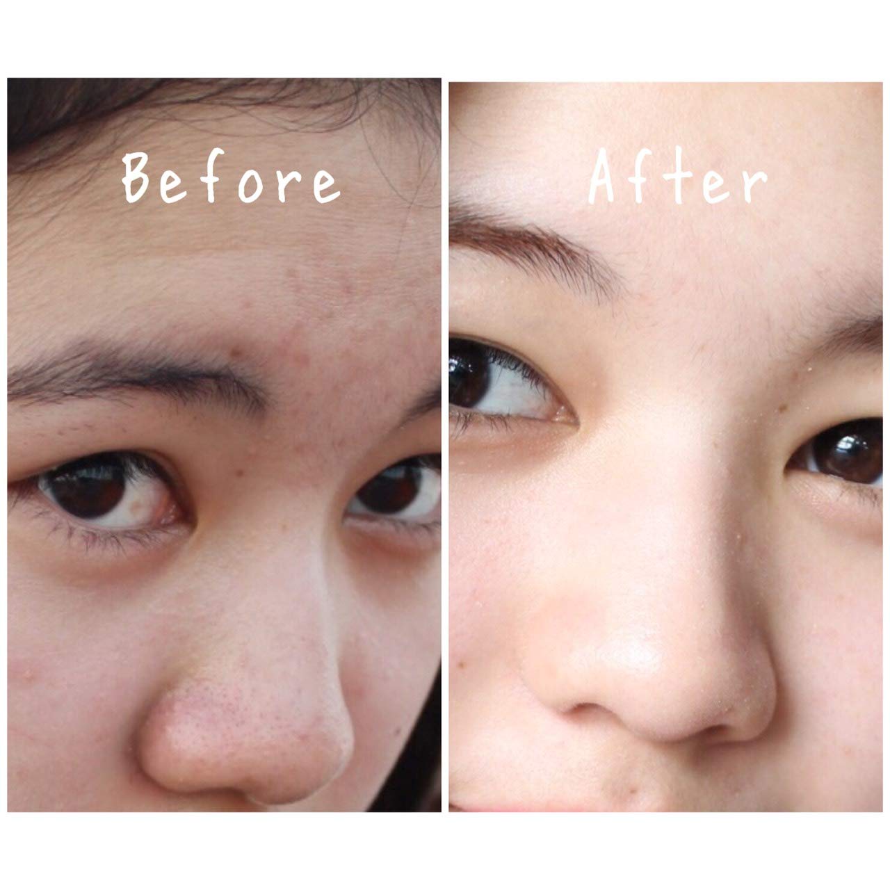 rojukiss acne poreless serum
