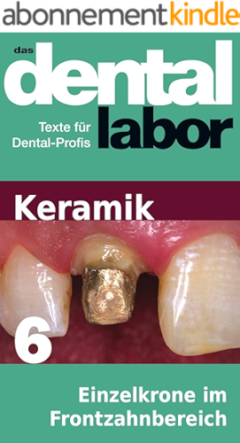 Download Einzelkrone im Frontzahnbereich (das dental labor Fachtexte 33) (German Edition) PDF