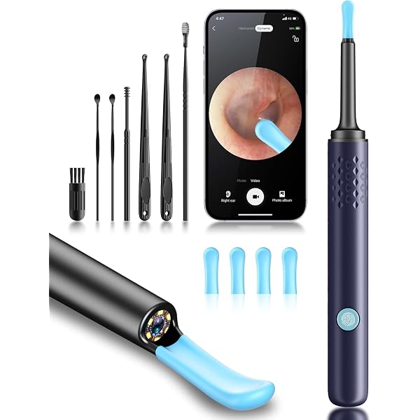 Wireless Otoscope Earwax Removal Tool
