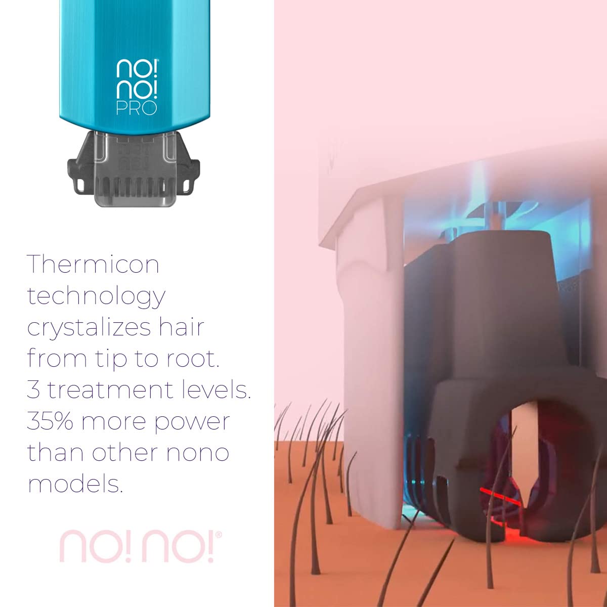 no!no! Pro Hair Removal Device - Treats All Skin Colors and Hair Types - Hair Removal for Women and Men - Hair Remover for Face & Body Hair - Blue