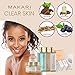 Makari Classic Pimple Drying Treatment 1.0 fl.oz - Acne Spot Cream With Salicylic Acid & Calamine - Fast-Drying Treatment for Acne Blemishes, Whiteheads, Blackheads, Irritation & Redness