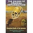 The Enigma of Cranial Deformation: Elongated Skulls of the Ancients
