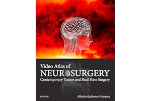 Video Atlas of Neurosurgery E-Book