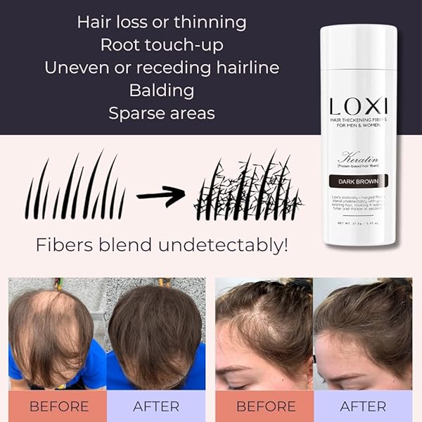 LOXI HAIR BUILDING FIBERS (27.5G) | FILL IN FINE, THINNING & BALDING HAIR FOR AN INSTANTLY THICKER & FULLER LOOK | PREMIUM KERATIN FORMULA | 5 SHADES FOR MEN & WOMEN (BLACK).