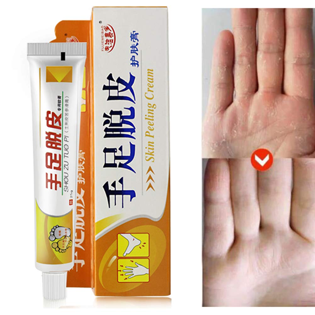 cream for peeling hands