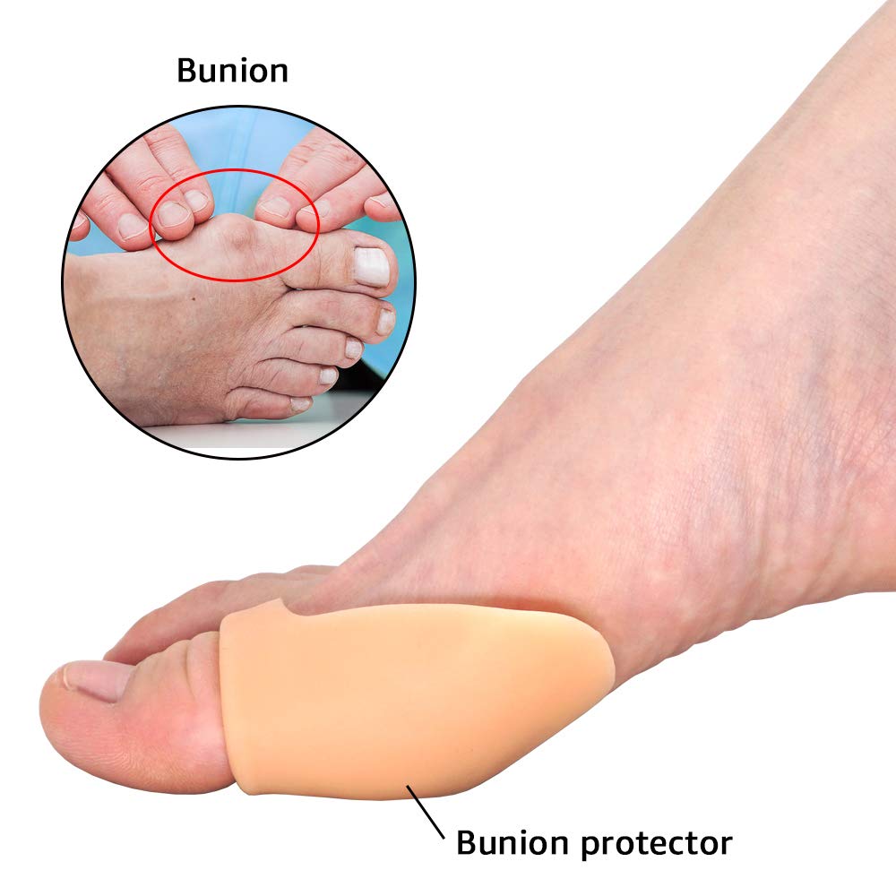 Dr. Foot Bunion Protector Pads, Toe Guards For Pinky Toes and Big Toes, Tailors Bunion Gel Shields Cushion