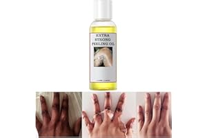 Peeling Oil for Dark Skin, Peeling Solution with Salicylic Acid, Exfoliating for Body, Dull Skin, Peeling Solutions For All S